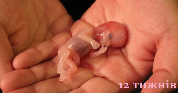 Аборт - помилка ціною в життя