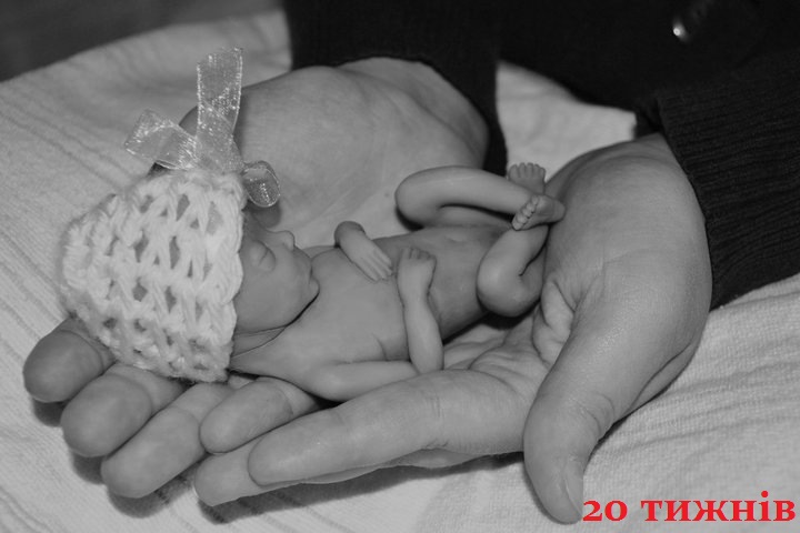 Аборт - помилка ціною в життя