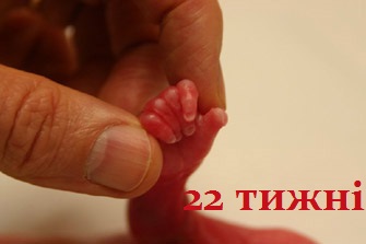 Аборт - помилка ціною в життя